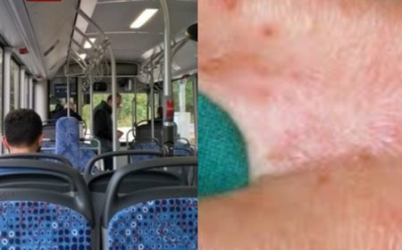 არის თუ არა მუნით დაინფიცირების საფრთხე საზოგადოებრივ ტრანსპორტში - "მხოლოდ კანის კანთან მჭიდრო კონტაქტით ხდება მისი გადადება"