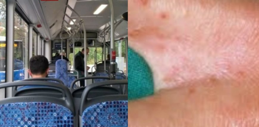 არის თუ არა მუნით დაინფიცირების საფრთხე საზოგადოებრივ ტრანსპორტში - "მხოლოდ კანის კანთან მჭიდრო კონტაქტით ხდება მისი გადადება"